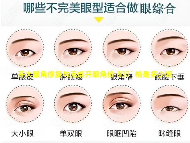 开大眼角修复与无痕开眼角价 🐴 格是多少呢